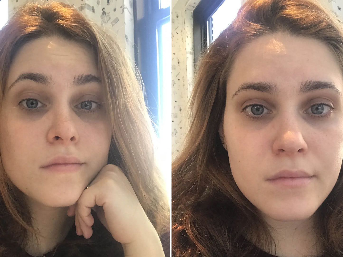 Patchs Dorés pour les Yeux – Éclat et Hydratation Intense