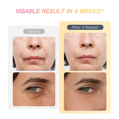 💎 Appareil Beauté Visage & Yeux 6-en-1 – IBORRIA